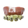Dientes braquets